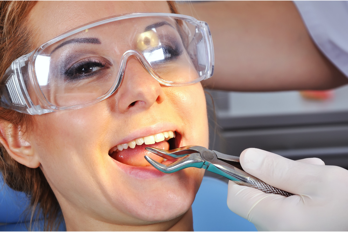 Tooth Extraction in London